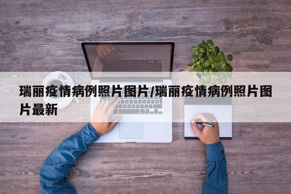 瑞丽疫情病例照片图片／瑞丽疫情病例照片图片最新